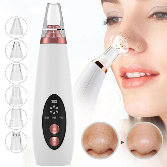 Rechargeable Blackhead Remover and Pore Vacuum Cleaner